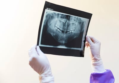 consulte-con-el-dentista-sobre-ortodoncia